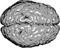 Medial longitudinal fissure